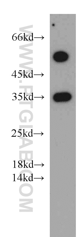 Western Blot (WB) analysis of Jurkat cells using Syntaxin 11 Polyclonal antibody (13301-1-AP)
