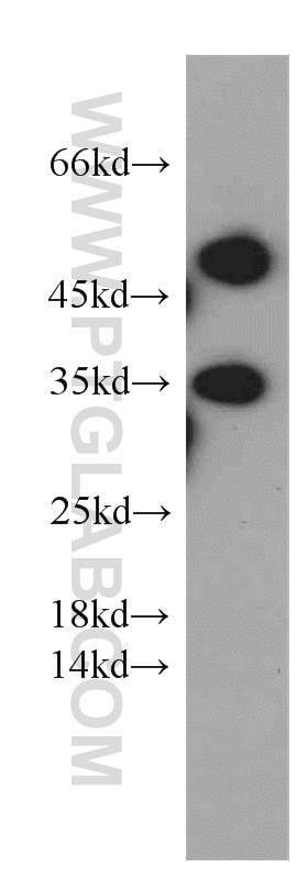 Western Blot (WB) analysis of DU 145 cells using Syntaxin 11 Polyclonal antibody (13301-1-AP)