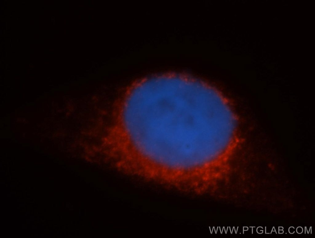 Immunofluorescence (IF) / fluorescent staining of HepG2 cells using Syntaxin 12 Polyclonal antibody (14259-1-AP)