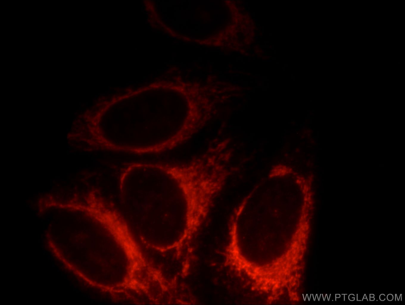 IF Staining of HepG2 using 14259-1-AP