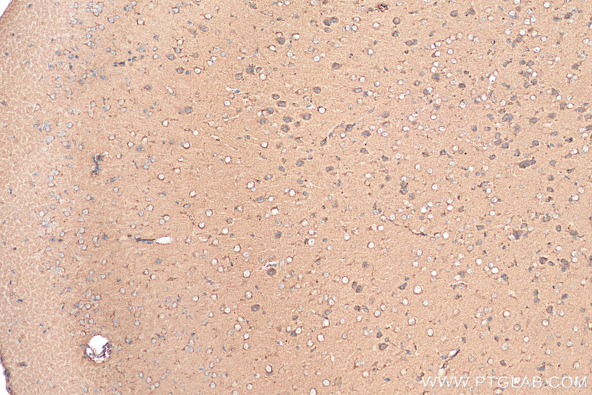 Immunohistochemistry (IHC) staining of mouse brain tissue using Syntaxin 12 Polyclonal antibody (14259-1-AP)