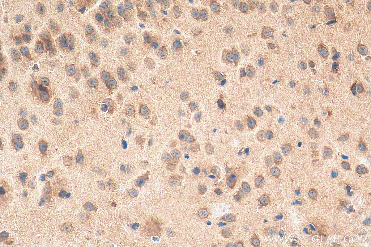 Immunohistochemistry (IHC) staining of mouse brain tissue using Syntaxin 12 Polyclonal antibody (14259-1-AP)