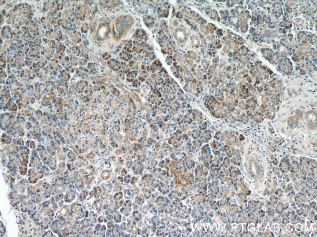 Immunohistochemistry (IHC) staining of human pancreas tissue using Syntaxin 12 Polyclonal antibody (14259-1-AP)