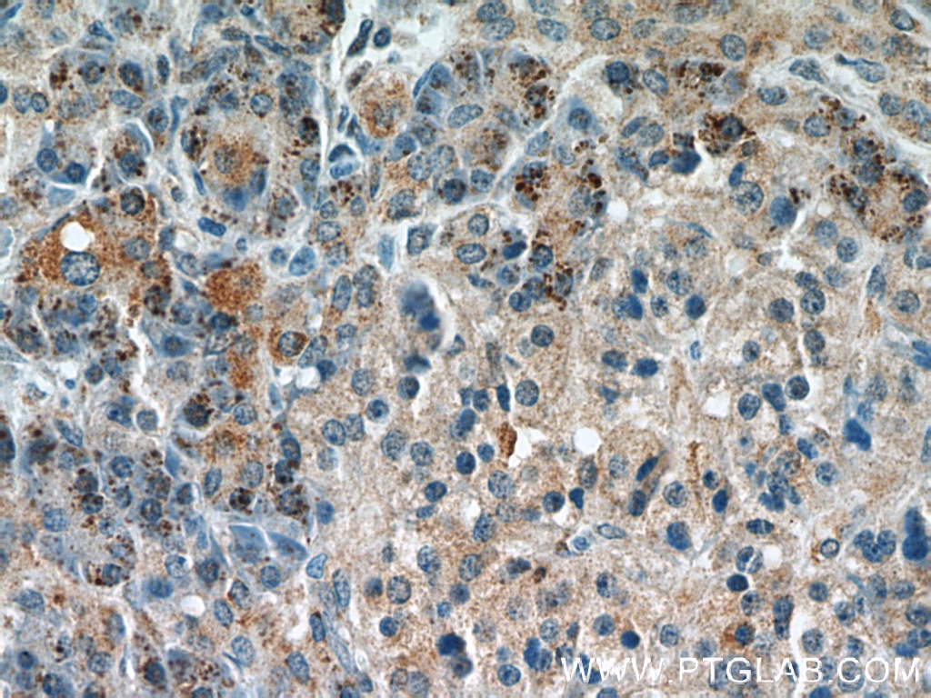 Immunohistochemistry (IHC) staining of human pancreas tissue using Syntaxin 12 Polyclonal antibody (14259-1-AP)