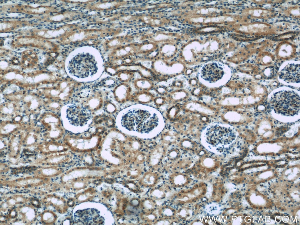 Immunohistochemistry (IHC) staining of human kidney tissue using Syntaxin 12 Polyclonal antibody (14259-1-AP)