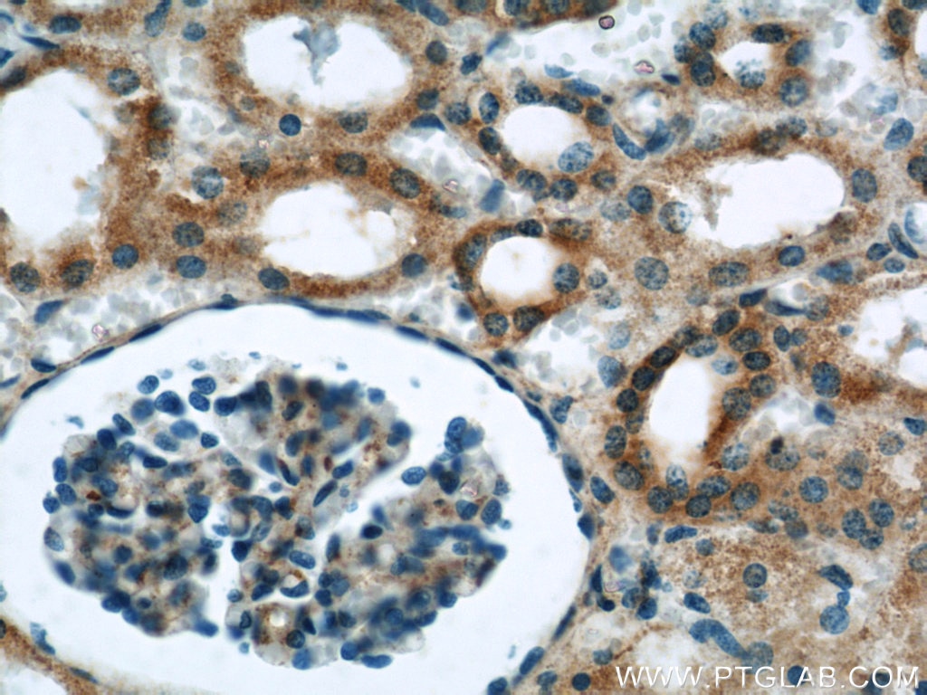 Immunohistochemistry (IHC) staining of human kidney tissue using Syntaxin 12 Polyclonal antibody (14259-1-AP)