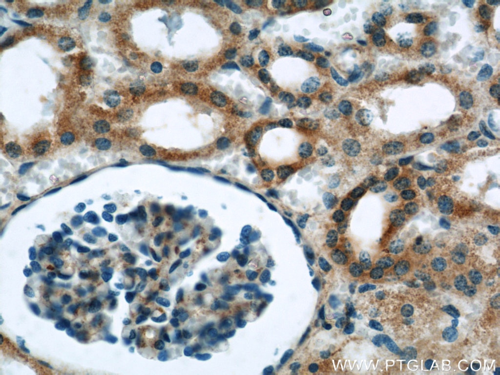 IHC staining of human kidney using 14259-1-AP