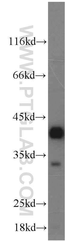 Western Blot (WB) analysis of human brain tissue using Syntaxin 12 Polyclonal antibody (14259-1-AP)