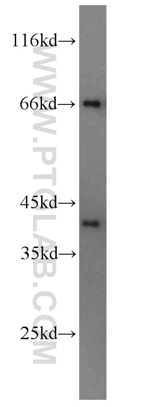 Western Blot (WB) analysis of human heart tissue using Syntaxin 12 Polyclonal antibody (14259-1-AP)