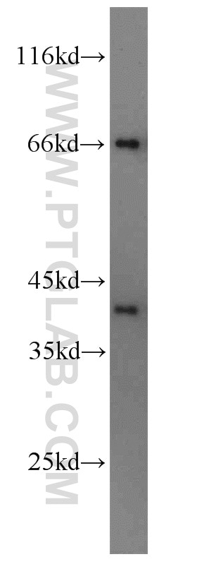 WB analysis of human heart using 14259-1-AP