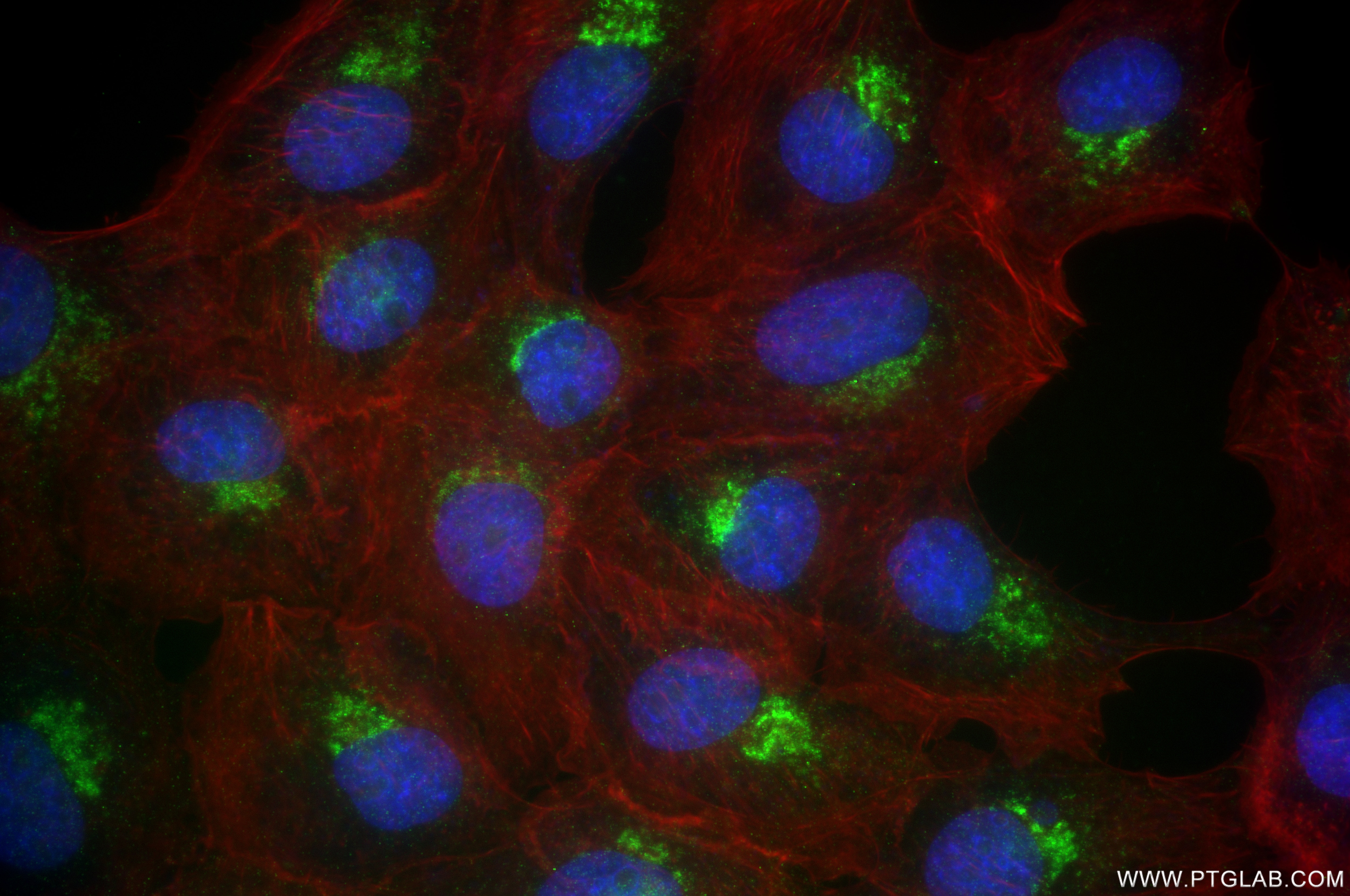 Immunofluorescence (IF) / fluorescent staining of A431 cells using Syntaxin 12 Recombinant antibody (85069-4-RR)