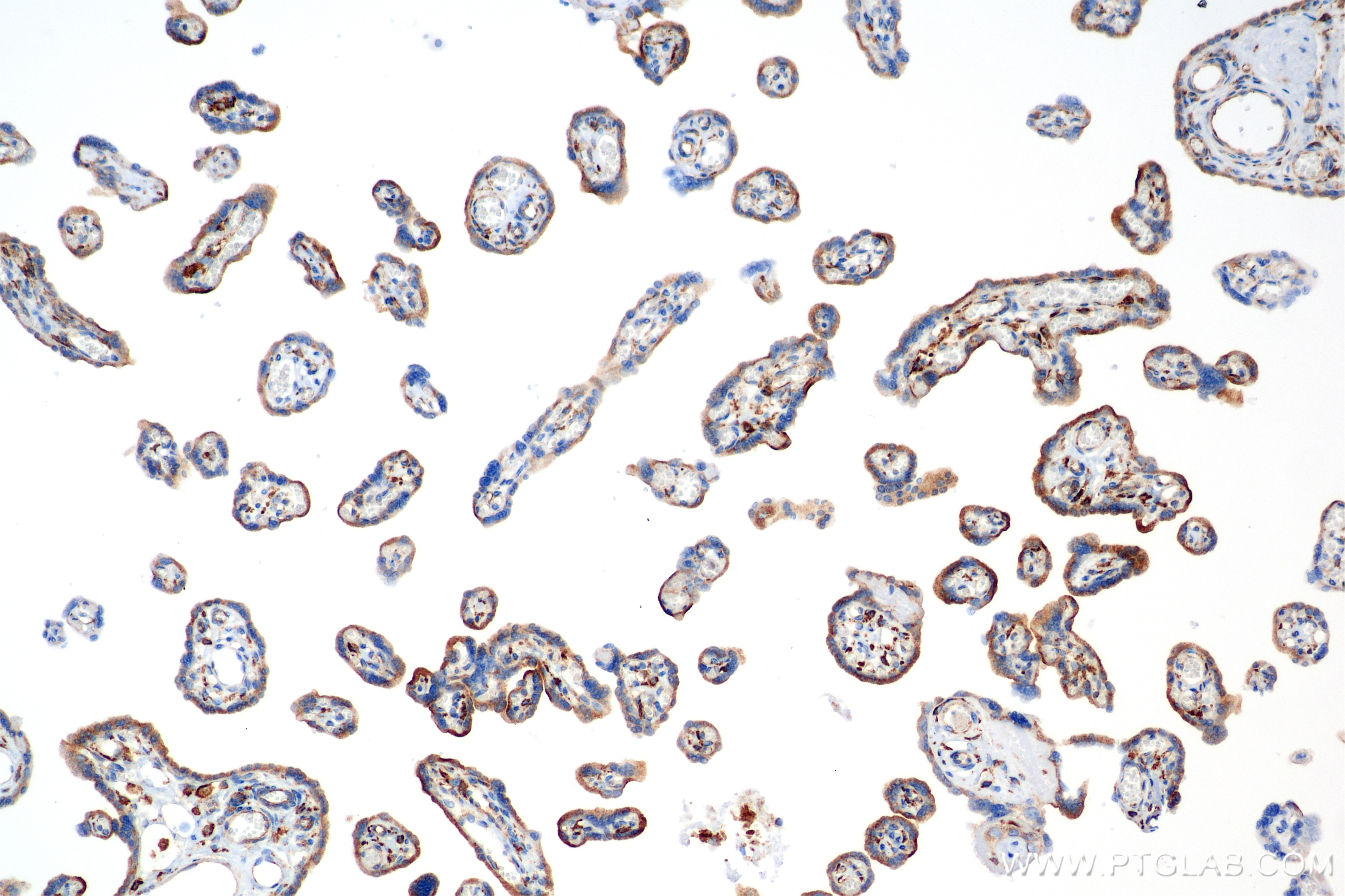Immunohistochemistry (IHC) staining of human placenta tissue using Syntaxin 12 Recombinant antibody (85069-4-RR)