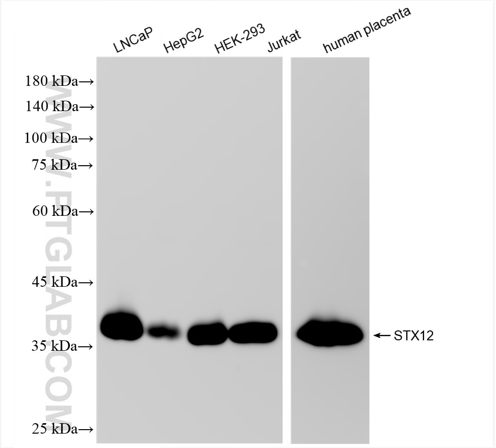 Western Blot (WB) analysis of various lysates using Syntaxin 12 Recombinant antibody (85069-4-RR)