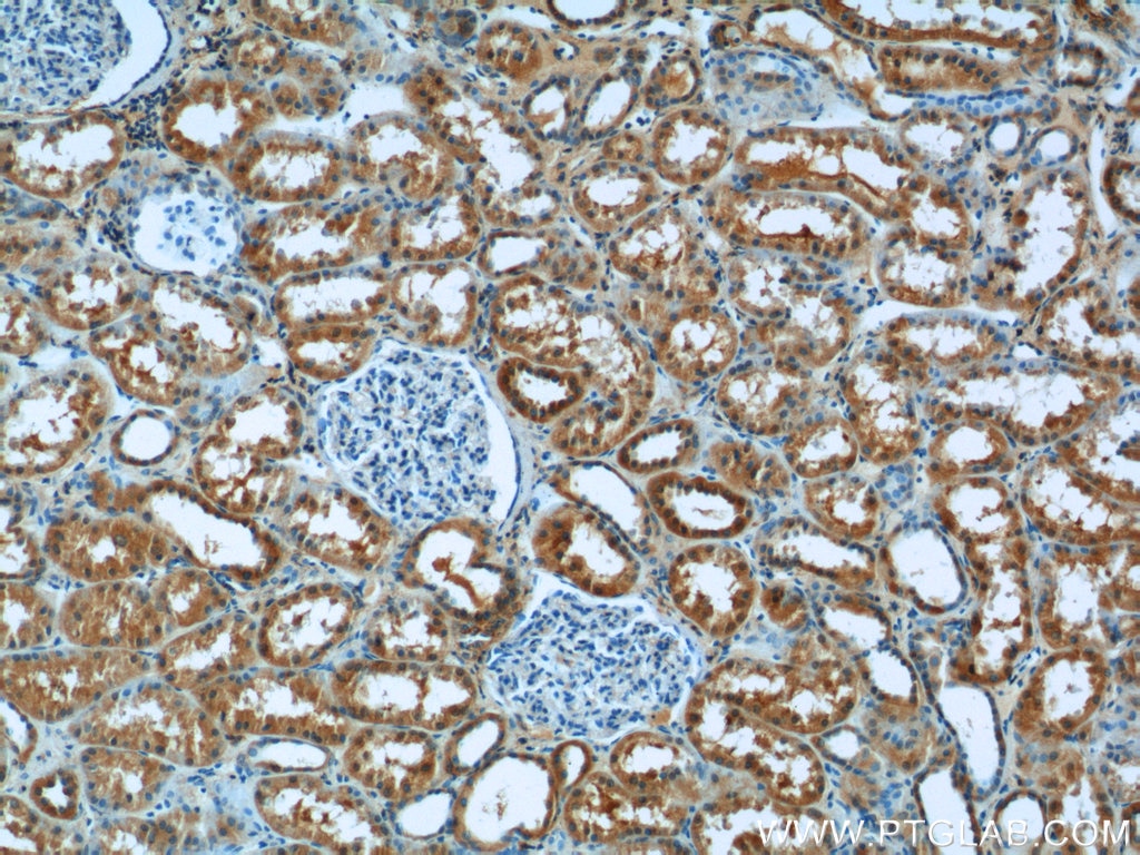 Immunohistochemistry (IHC) staining of human kidney tissue using Syntaxin 17 Polyclonal antibody (17815-1-AP)