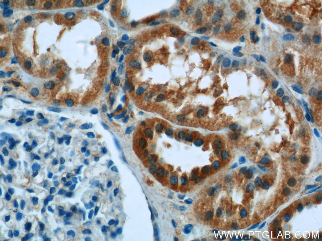 Immunohistochemistry (IHC) staining of human kidney tissue using Syntaxin 17 Polyclonal antibody (17815-1-AP)