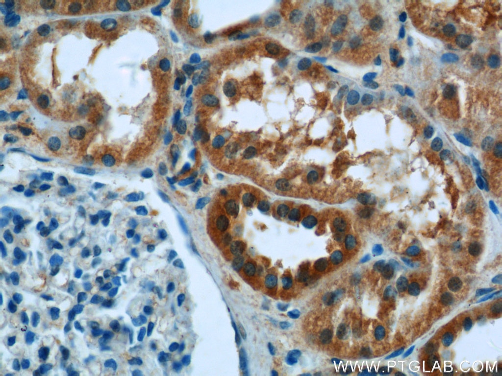 IHC staining of human kidney using 17815-1-AP