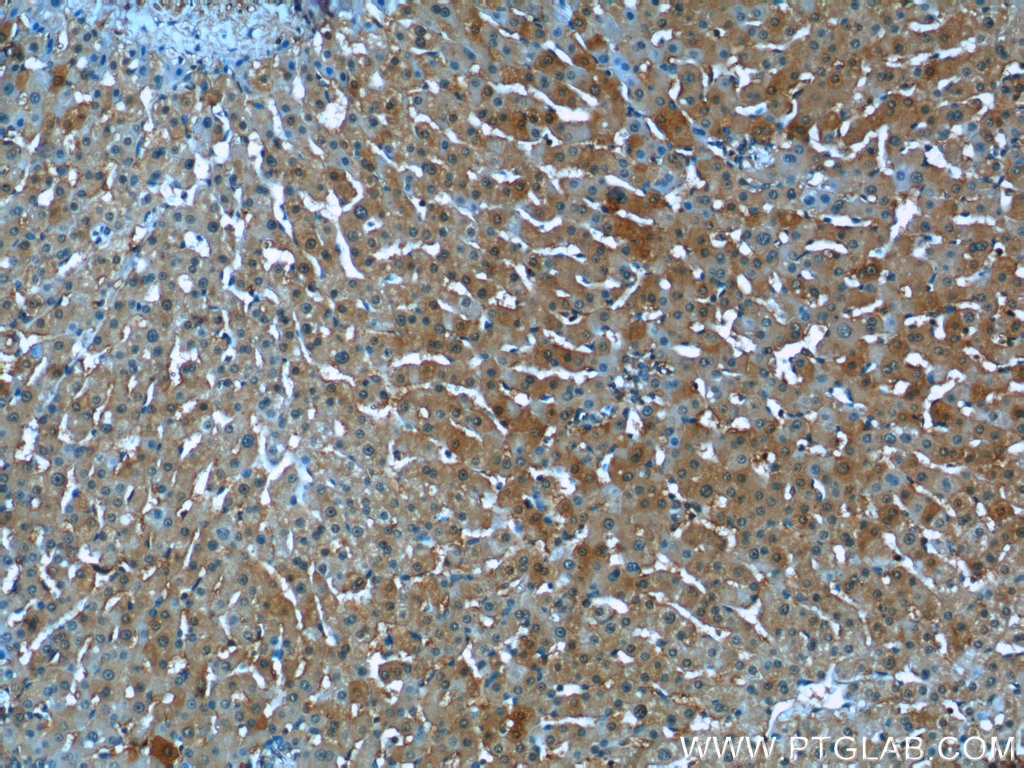 Immunohistochemistry (IHC) staining of human liver tissue using Syntaxin 17 Polyclonal antibody (17815-1-AP)