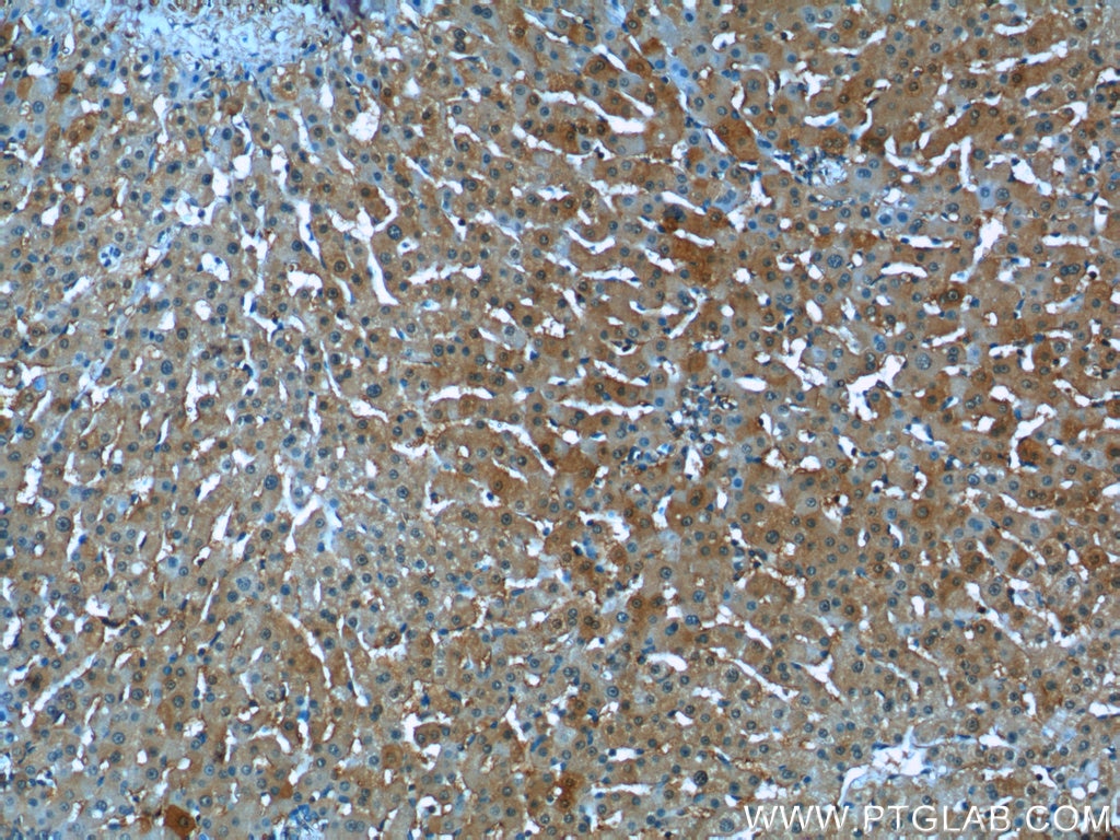 Immunohistochemistry (IHC) staining of human liver tissue using STX17 Polyclonal antibody (17815-1-AP)