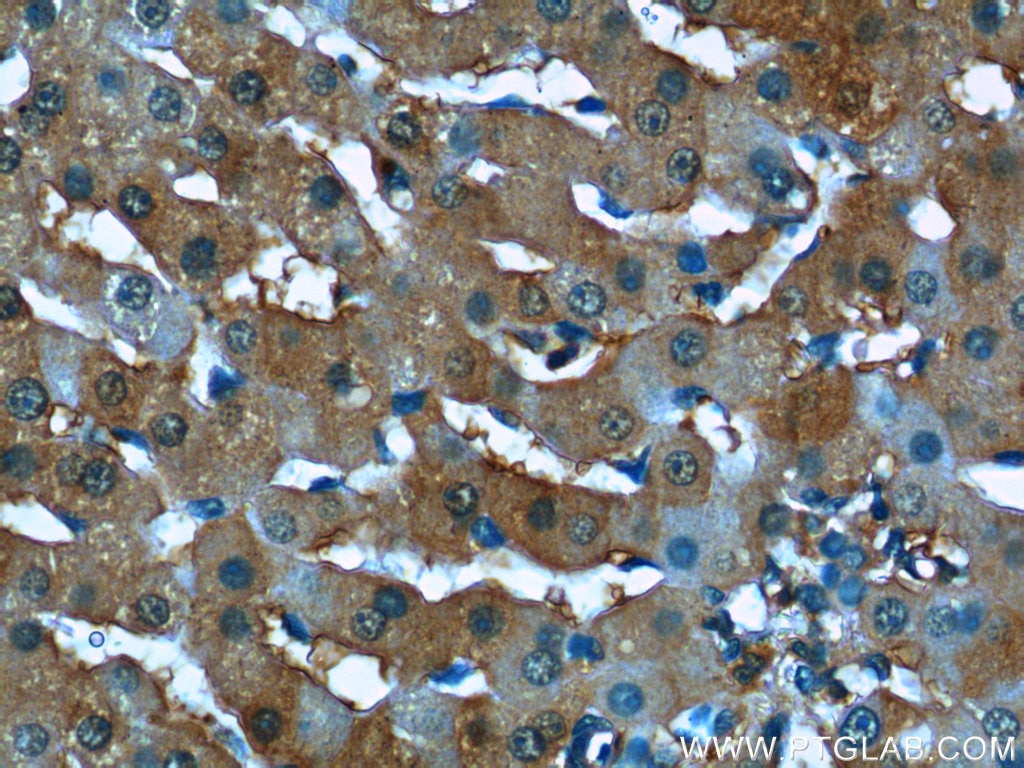Immunohistochemistry (IHC) staining of human liver tissue using STX17 Polyclonal antibody (17815-1-AP)