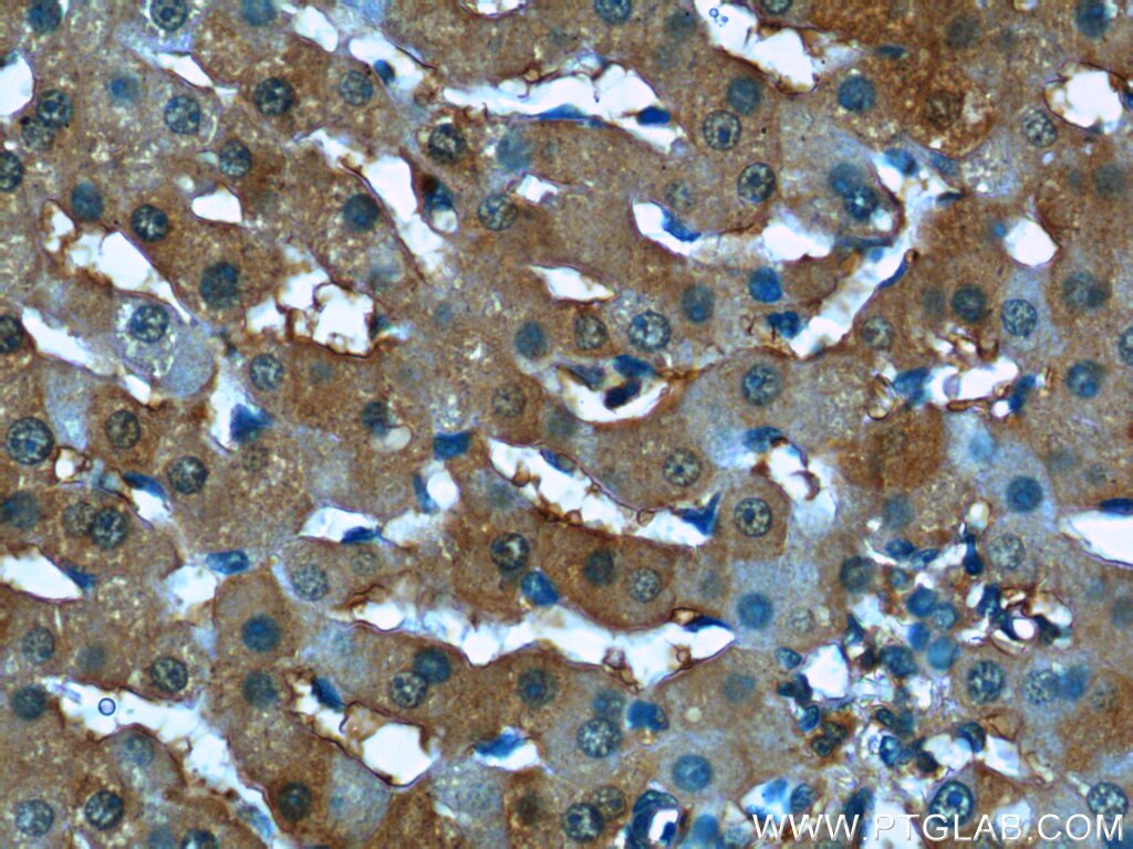 Immunohistochemistry (IHC) staining of human liver tissue using Syntaxin 17 Polyclonal antibody (17815-1-AP)