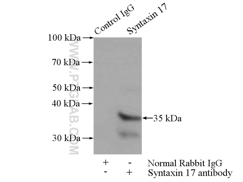 Immunoprecipitation (IP) experiment of HepG2 cells using STX17 Polyclonal antibody (17815-1-AP)
