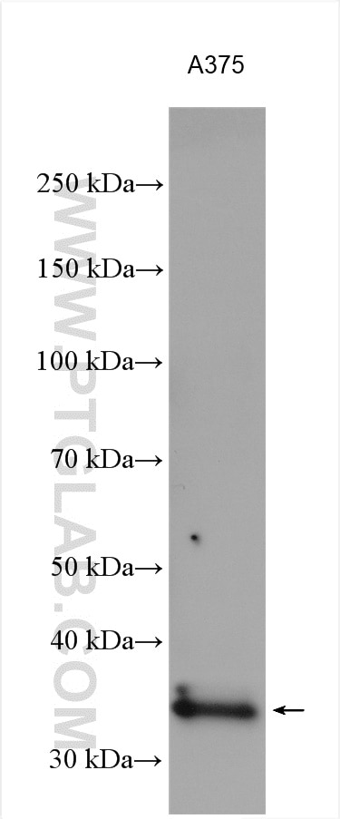 Western Blot (WB) analysis of A375 cells using Syntaxin 17 Polyclonal antibody (17815-1-AP)
