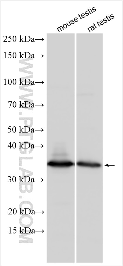 Western Blot (WB) analysis of various lysates using STX17 Polyclonal antibody (17815-1-AP)