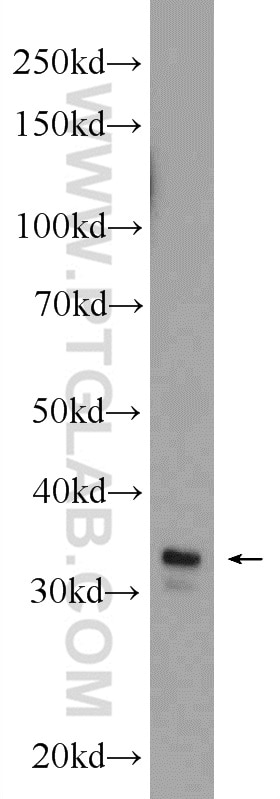 Western Blot (WB) analysis of human testis tissue using STX17 Polyclonal antibody (17815-1-AP)