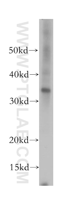 Western Blot (WB) analysis of HepG2 cells using STX17 Polyclonal antibody (17815-1-AP)