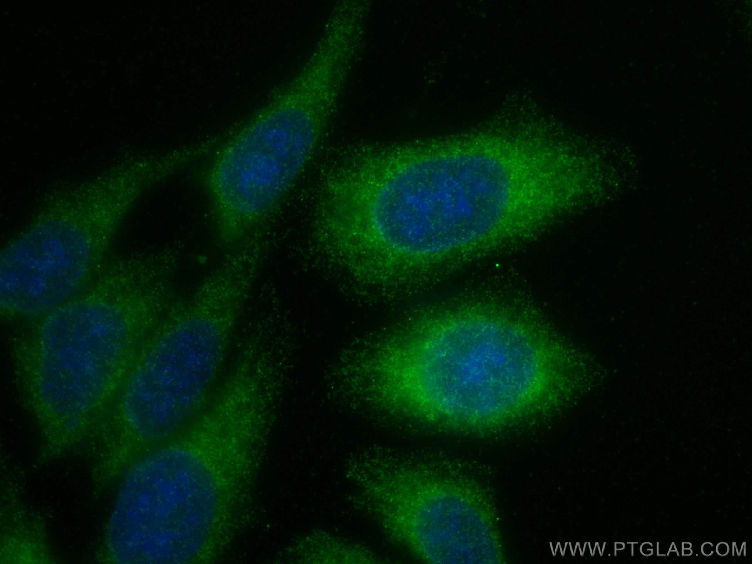 Immunofluorescence (IF) / fluorescent staining of HepG2 cells using STX17 Recombinant antibody (81899-1-RR)