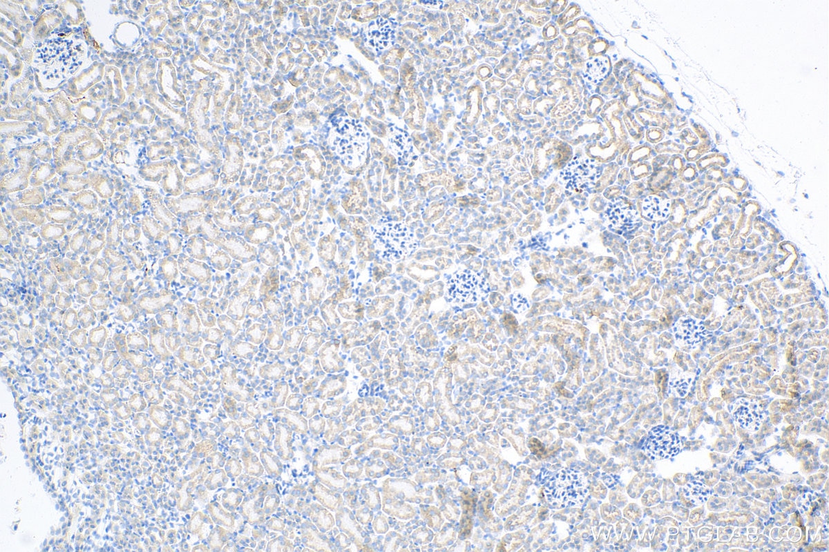 Immunohistochemistry (IHC) staining of mouse kidney tissue using STX17 Recombinant antibody (81899-1-RR)