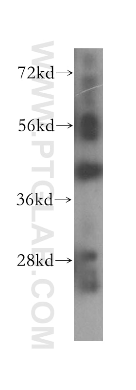 Western Blot (WB) analysis of human spleen tissue using Syntaxin 18 Polyclonal antibody (16013-1-AP)
