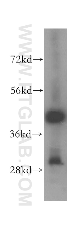 Western Blot (WB) analysis of human liver tissue using Syntaxin 18 Polyclonal antibody (16013-1-AP)