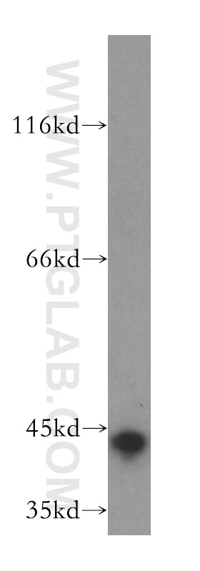 Western Blot (WB) analysis of human liver tissue using Syntaxin 18 Polyclonal antibody (16013-1-AP)