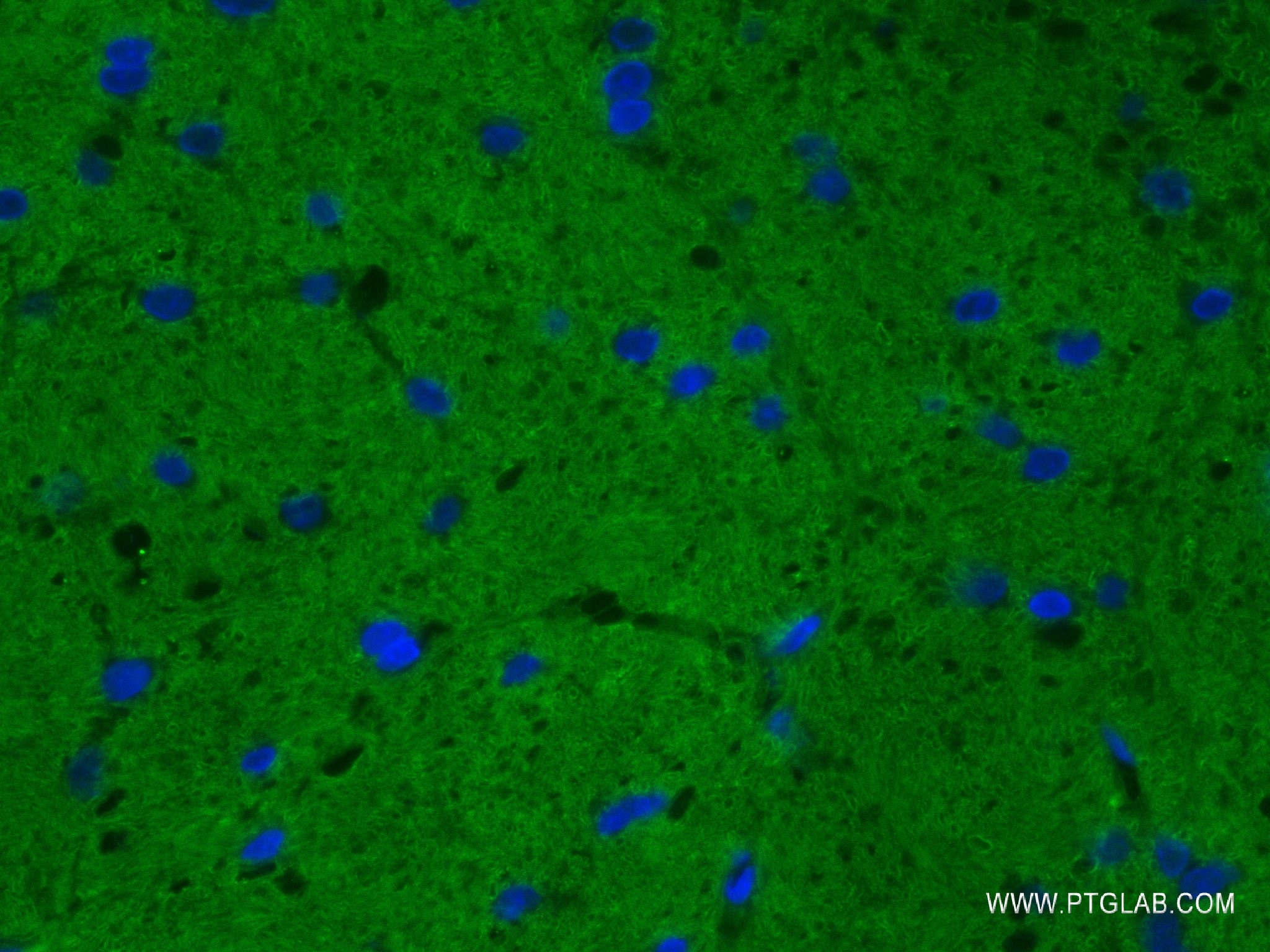 Immunofluorescence (IF) / fluorescent staining of mouse cerebellum tissue using STX1A Recombinant antibody (83159-6-RR)