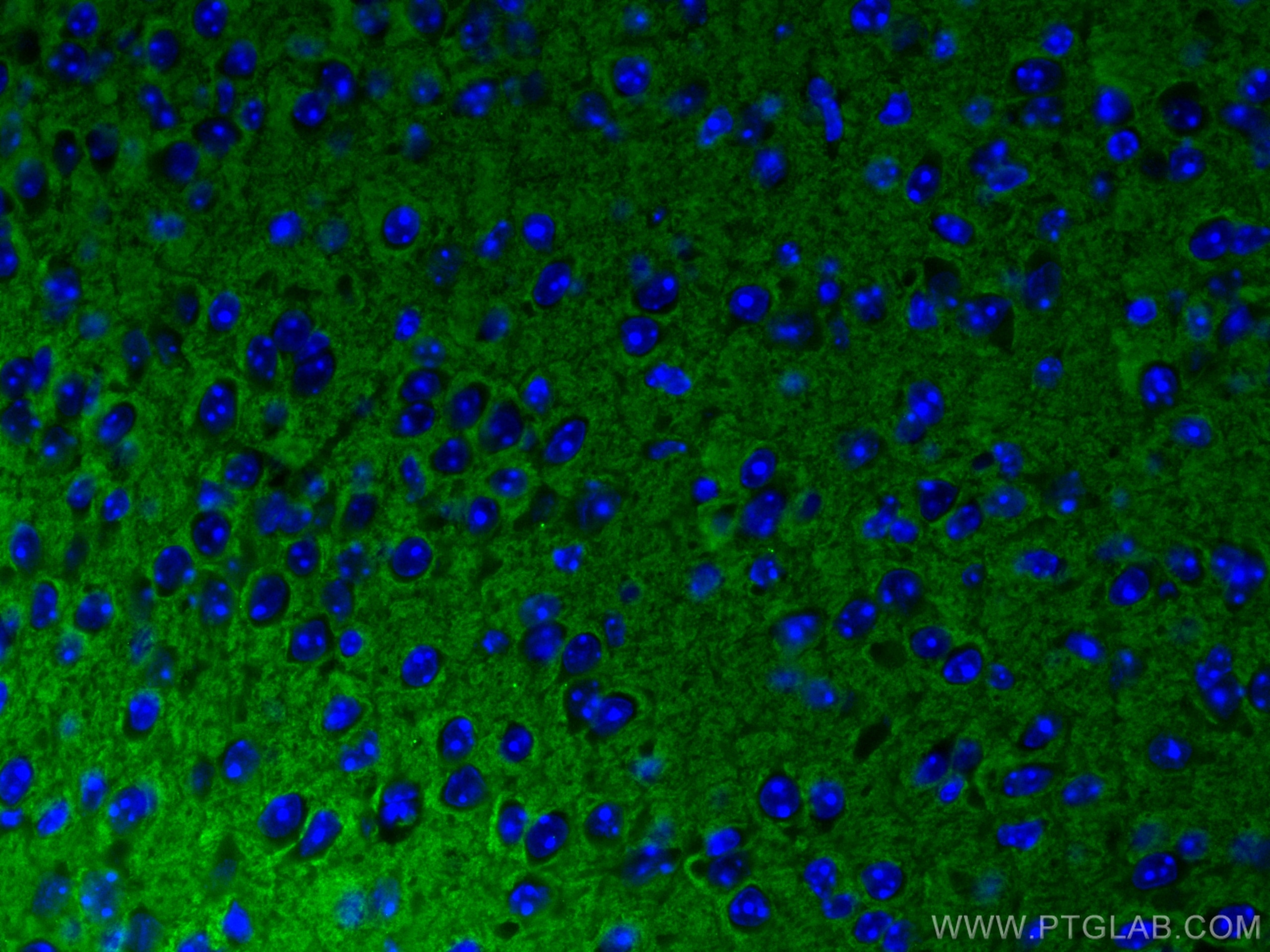 Immunofluorescence (IF) / fluorescent staining of mouse brain tissue using Syntaxin 1A / Syntaxin 1B Monoclonal antibody (66437-1-Ig)