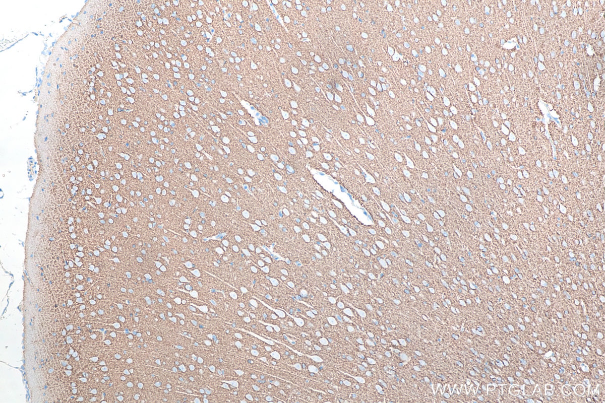 Immunohistochemistry (IHC) staining of rat brain tissue using Syntaxin 1B Monoclonal antibody (66437-1-Ig)