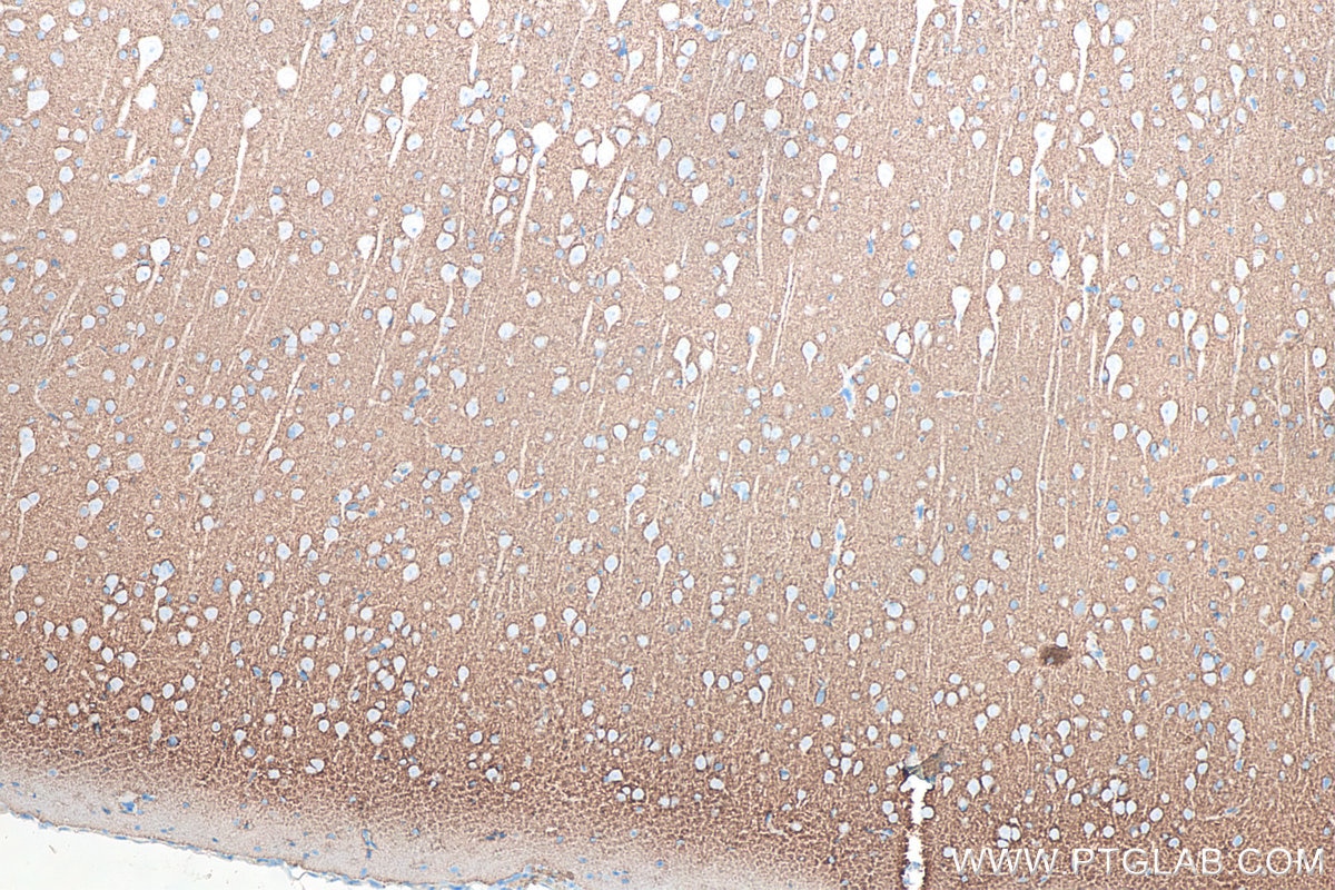 IHC staining of rat brain using 66437-1-Ig