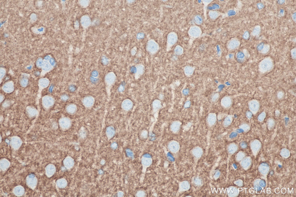 Immunohistochemistry (IHC) staining of rat brain tissue using Syntaxin 1A / Syntaxin 1B Monoclonal antibody (66437-1-Ig)