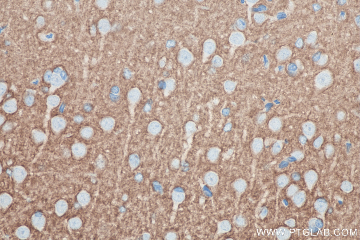 IHC staining of rat brain using 66437-1-Ig