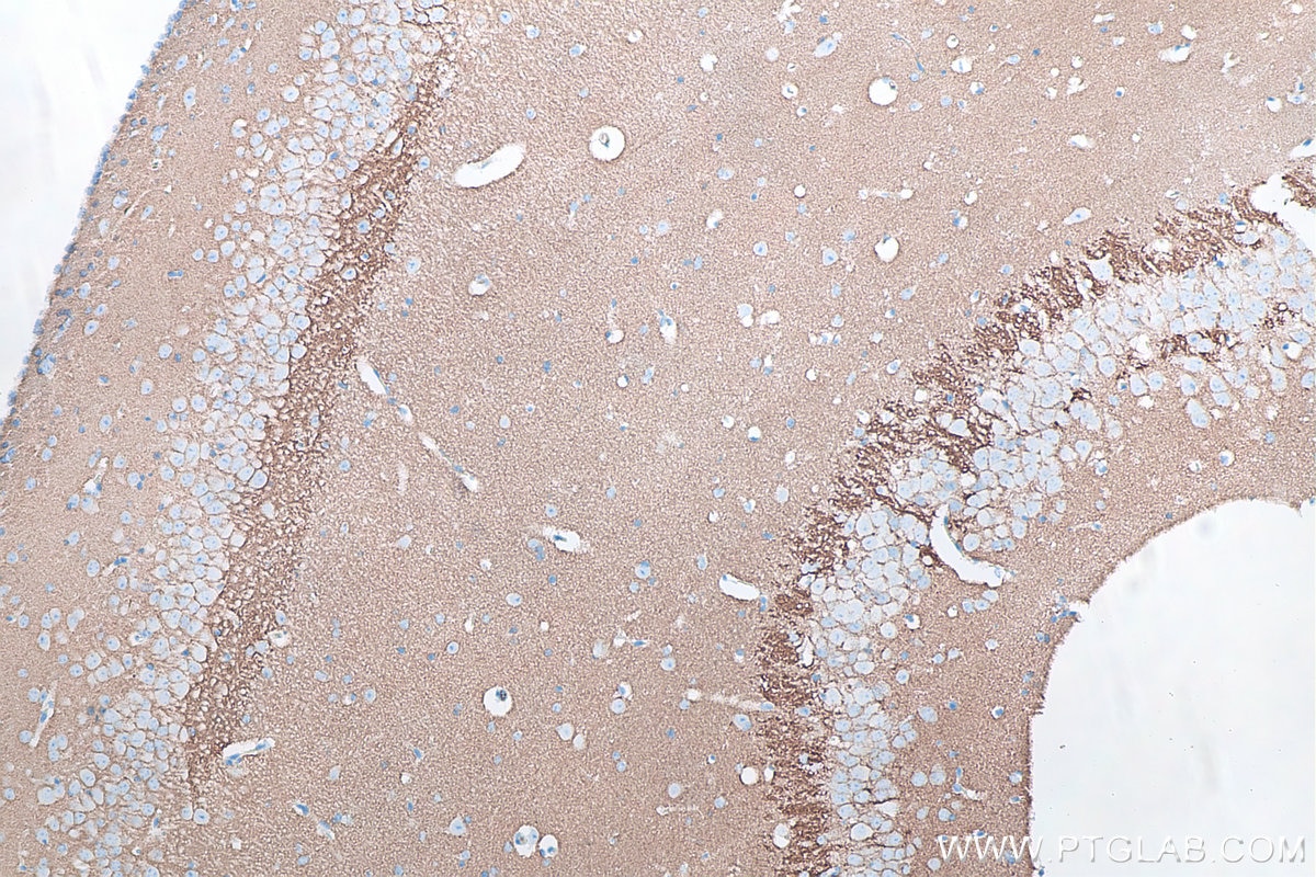 Immunohistochemistry (IHC) staining of mouse brain tissue using Syntaxin 1B Monoclonal antibody (66437-1-Ig)