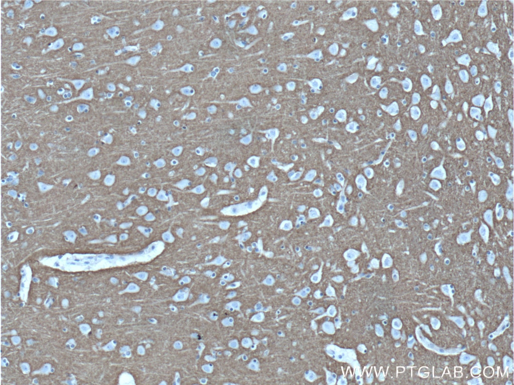 Immunohistochemistry (IHC) staining of human brain tissue using Syntaxin 1A / Syntaxin 1B Monoclonal antibody (66437-1-Ig)