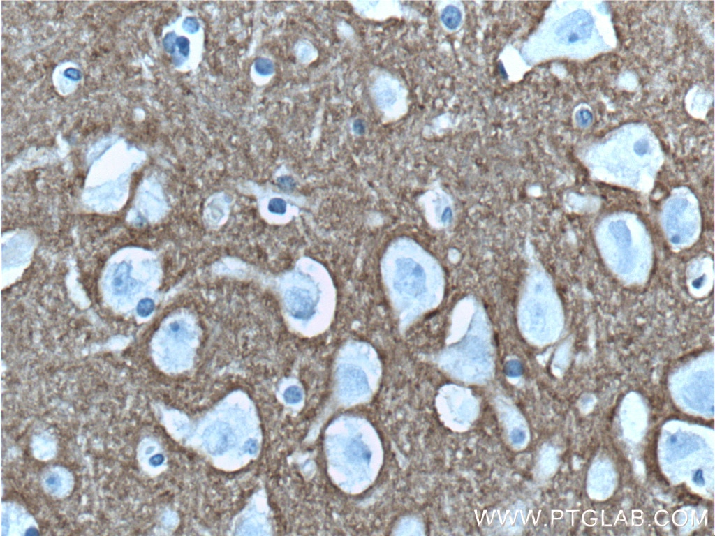 Immunohistochemistry (IHC) staining of human brain tissue using Syntaxin 1A / Syntaxin 1B Monoclonal antibody (66437-1-Ig)