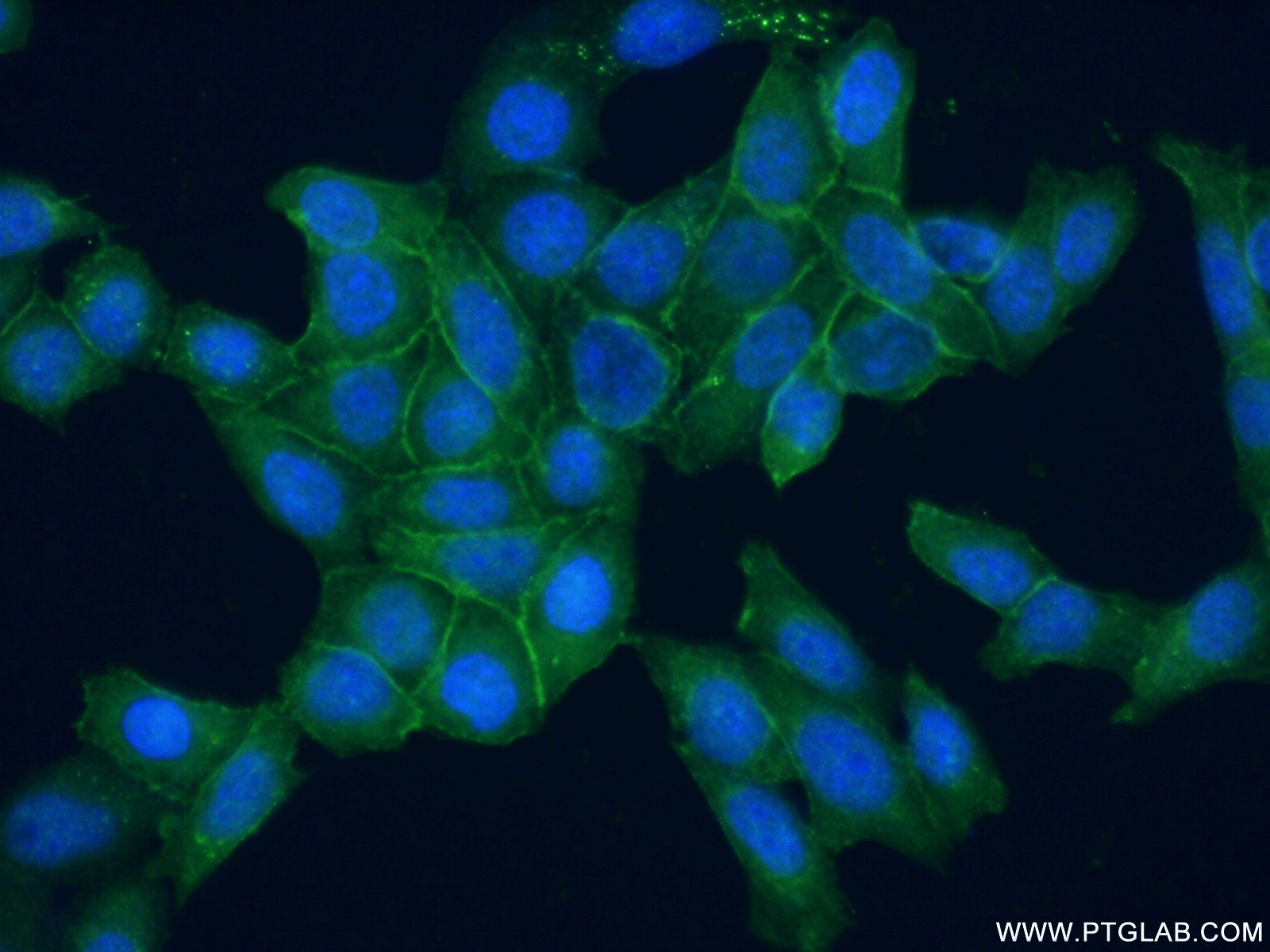 Immunofluorescence (IF) / fluorescent staining of HeLa cells using Syntaxin 2 Polyclonal antibody (55033-1-AP)