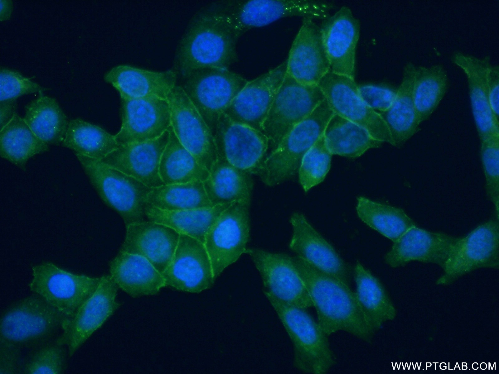 IF Staining of HeLa using 55033-1-AP