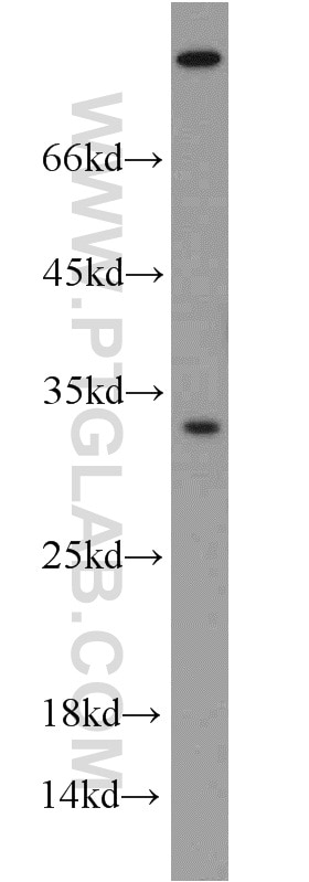 Western Blot (WB) analysis of HeLa cells using Syntaxin 2 Polyclonal antibody (55033-1-AP)
