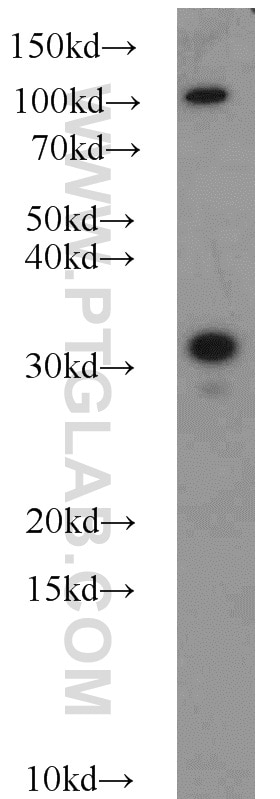Western Blot (WB) analysis of HeLa cells using Syntaxin 2 Polyclonal antibody (55033-1-AP)