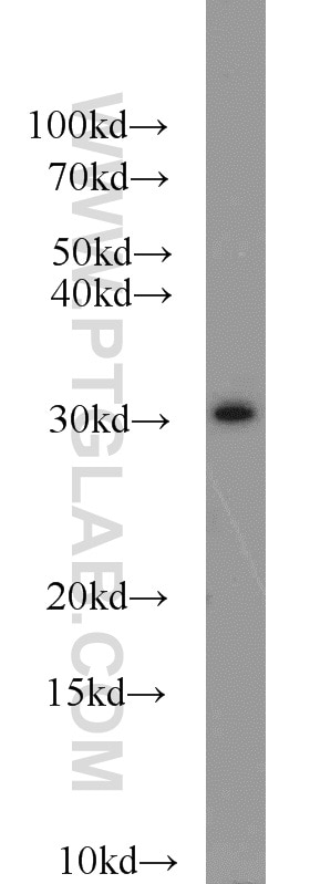 Western Blot (WB) analysis of A431 cells using Syntaxin 2 Polyclonal antibody (55033-1-AP)