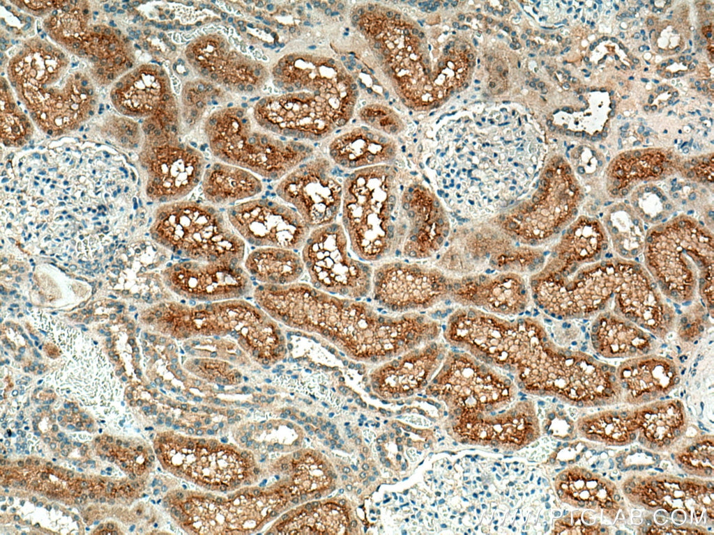 Immunohistochemistry (IHC) staining of human kidney tissue using Syntaxin 3 Polyclonal antibody (15556-1-AP)