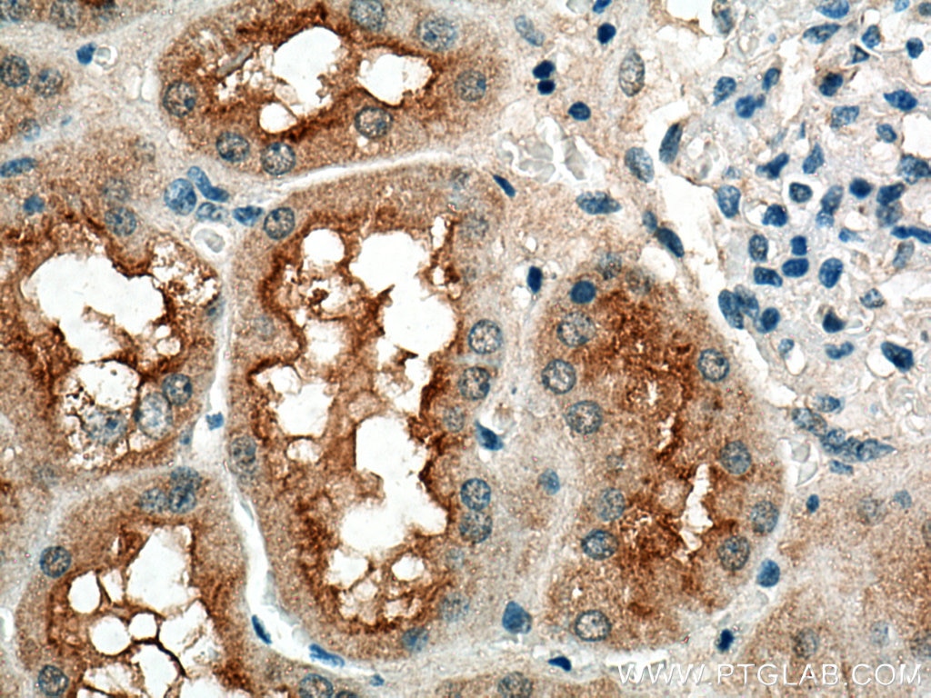 Immunohistochemistry (IHC) staining of human kidney tissue using Syntaxin 3 Polyclonal antibody (15556-1-AP)